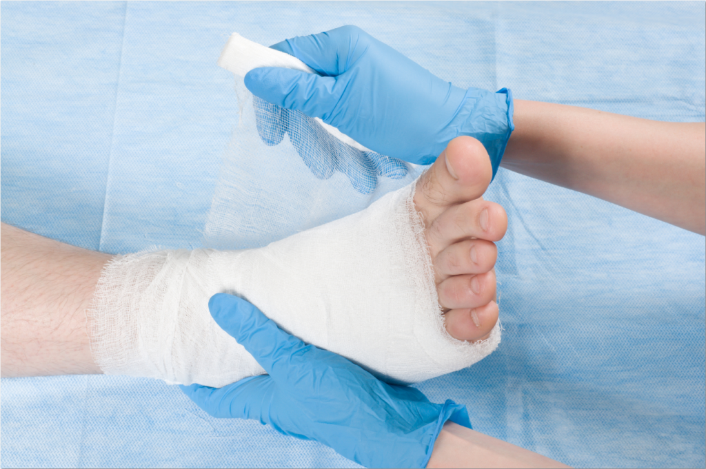 Athletic Foot Care, Treatment and Surgery In Mercer Island