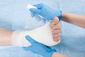Claw Toe Treatment and Surgery in Bellevue