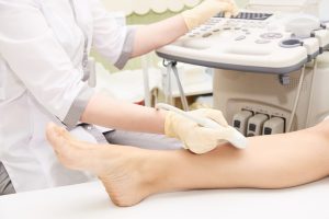 Chronic Lateral Ankle Pain, Treatment, and Surgery in Monroe