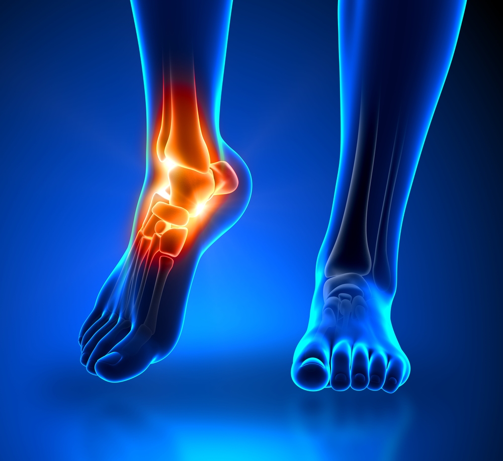 Foot and Ankle Fractures Treatment In Bothell-Mill Creek, WA